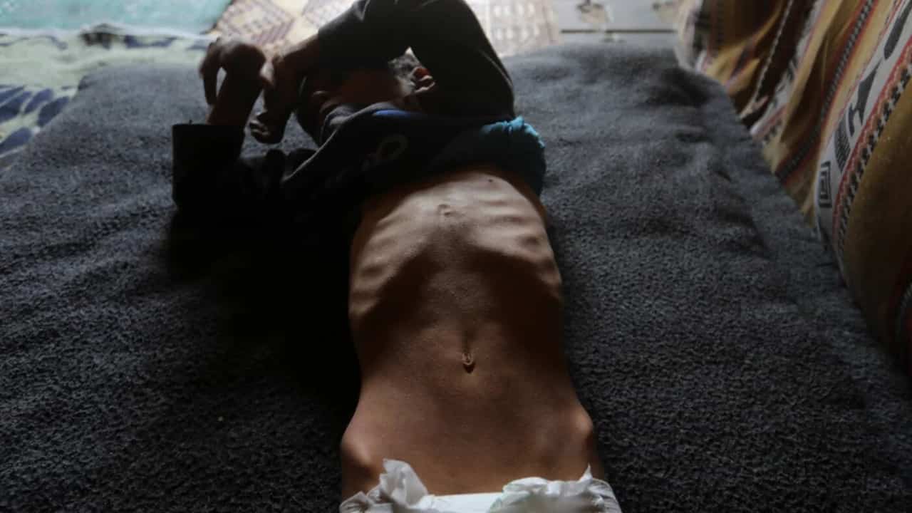 Israel's blockade of Gaza causes severe child malnutrition and stunting