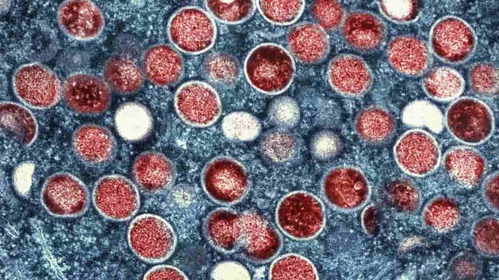 Hong Kong urges mpox vaccination amid case surge