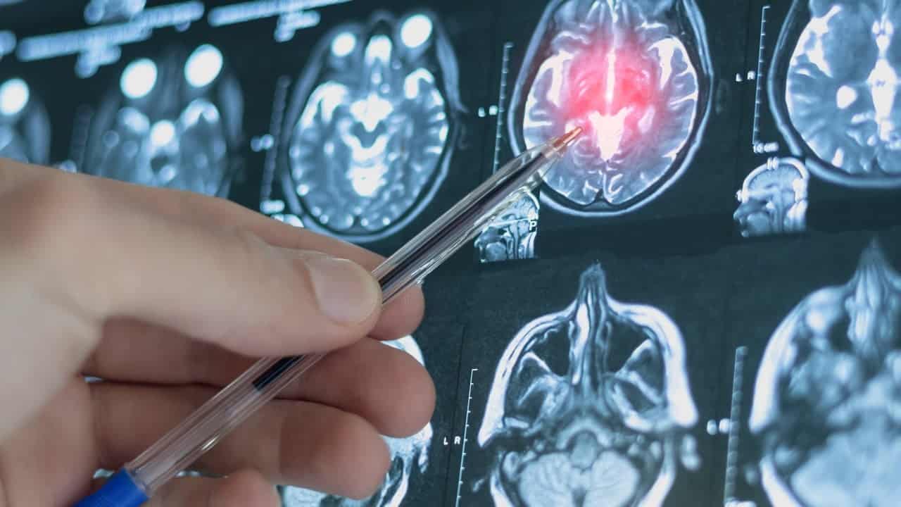 Chinese AI model may predict depression risk years in advance