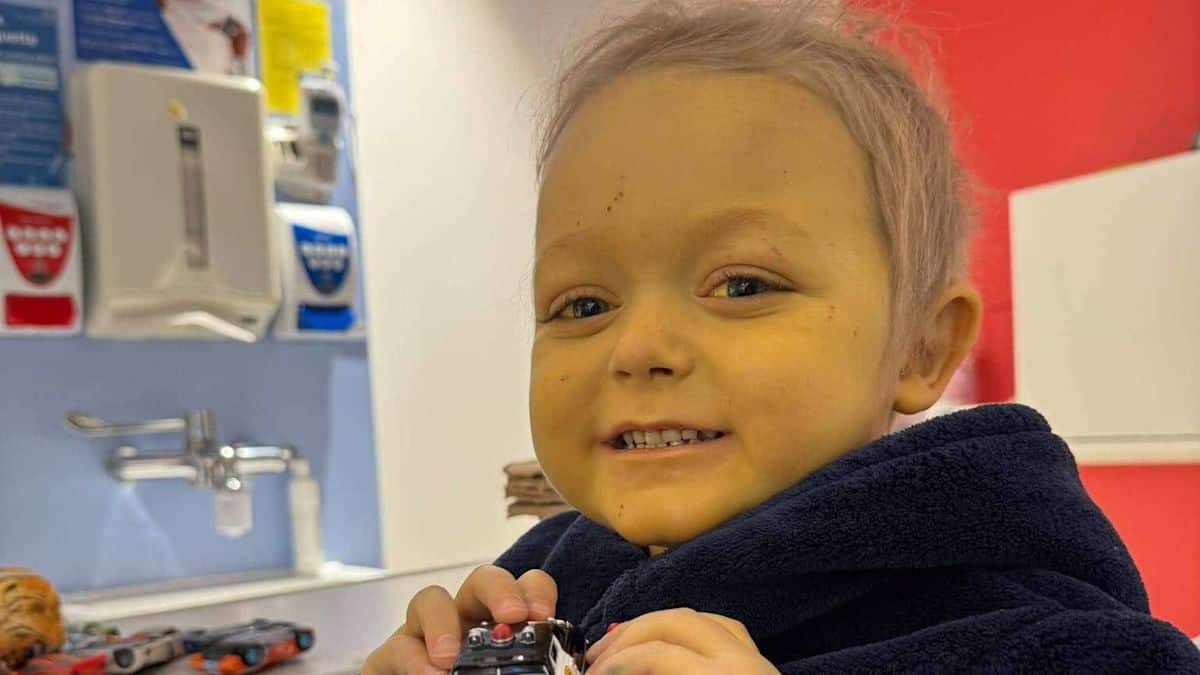 Father donates part of liver and bowel to son in rare transplant