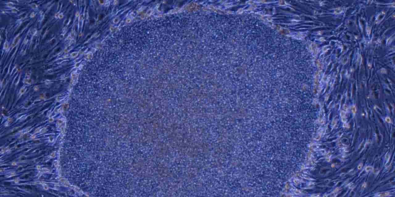 Japan aims to develop 'next-gen' iPS cells for strokes and kidney failure