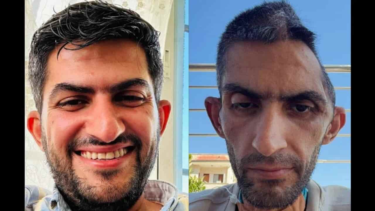Photos of Palestinian journalist released from Israeli prison spark outrage