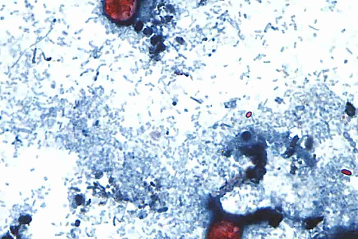 Trump administration cuts hinder response to record US cyclosporiasis outbreak