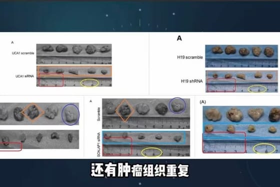Top Chinese Cancer Doctor Accused of Academic Fraud