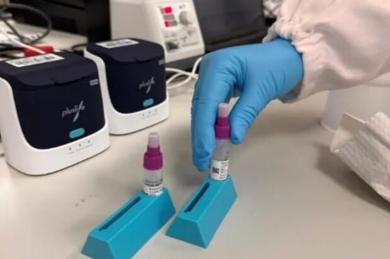 Global Fund Backs Chinese Test to Speed TB Diagnosis