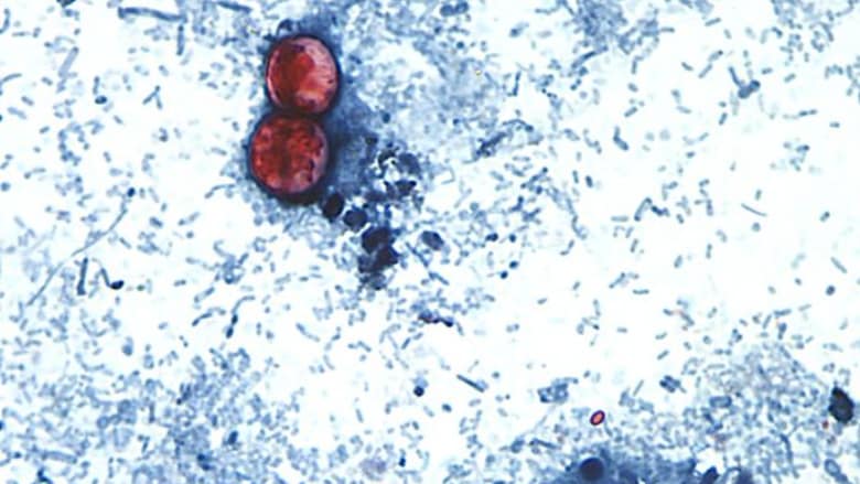 FDA found cyclospora at Taylor Farms Mexico site