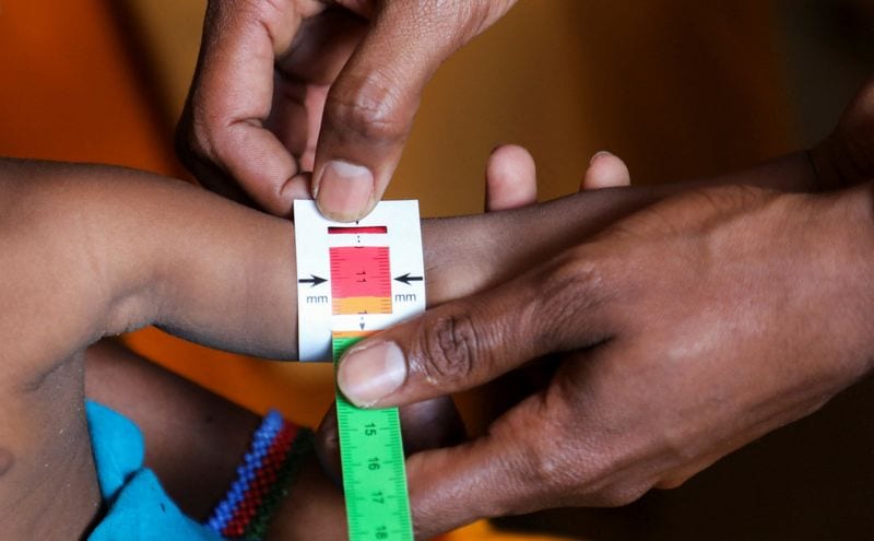 Somalia child hunger crisis deepens as aid cuts force facility closures