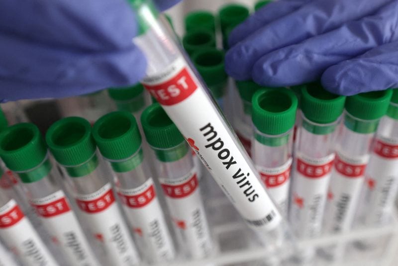 Mpox case confirmed in Bunia amid ongoing Ebola outbreak
